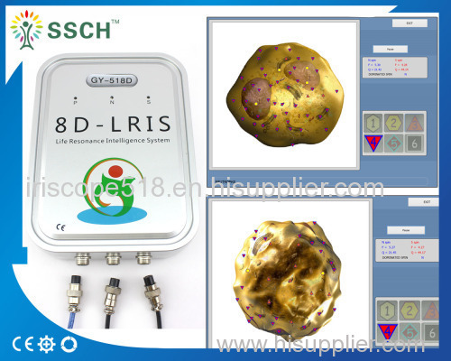 Naturopathic And Bioresonance 8d Nls Health Analyzer Machine High Accuracy English / Spanish