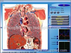 3D NLS Quantum Health Test Machine / Full Body Health Analyzer with DIACOM Version