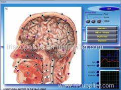 3D NLS Quantum Health Test Machine / Full Body Health Analyzer with DIACOM Version