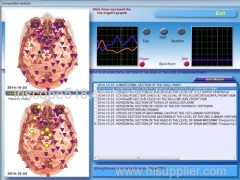 3D NLS Quantum Health Test Machine / Full Body Health Analyzer with DIACOM Version