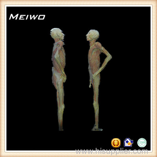 Face to face posture process of plastination