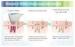 DiodeLaser Home Use Hair Removal Machine , Hand Hair Removal Machine for Home