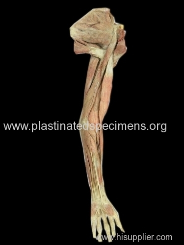 Superficial muscles of upper limb plastination