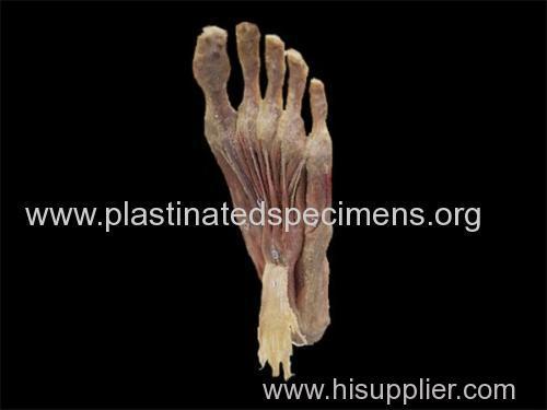 Superfical muscles of foot plastinated organ