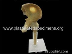 Hip joint human plastination process