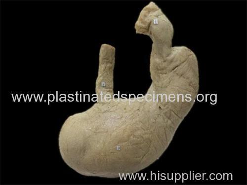 Stomach plastinated specimen supplier