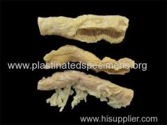 Jejunum ileum colon plastinated body