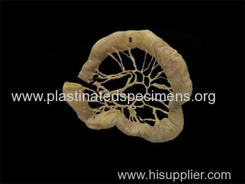 Jejunal vascular arcades plastinated specimens india