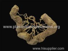 Ileum vascular arcades gunther von hagens plastination