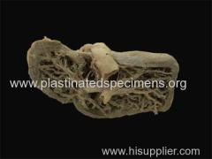 hepatic segments cost of plastinated specimens