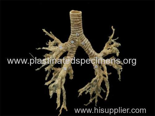 Bronchial tree buy plastinated specimens