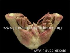 Female perineal muscle plastinated specimen for sale