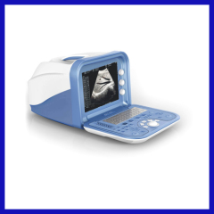 Full-digital Portable Ultrasound Scanner