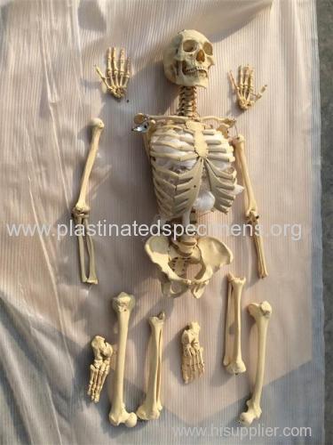Bones of the whole body disarticulated human skeletons