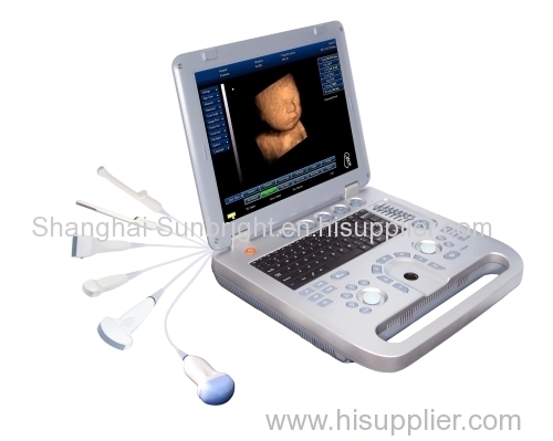 China 2015 New high quality 3d/4d laptop color ultrasound