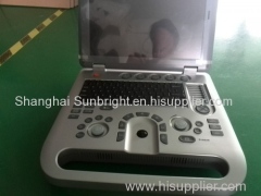 3D/4D laptop B/W ultrasound/advanced hand-carried 4D ultrasound with WIN7 operation system/64G RAM 4D ultrasound