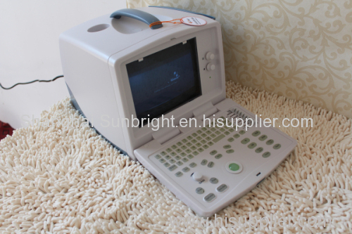 3D portable ultrasound with competitive price/3D pregnancy ultrasound for promotions