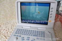 3D portable ultrasound with competitive price/3D pregnancy ultrasound for promotions