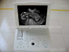 15 inch LCD laptop ultrasound/hot selling laptop ultrasound/Pregnancy ultrasound