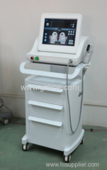 2015 New model high intensity focused ultrasound HIFU face lift anti wrinkle removal machine