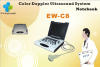 Laptop Ultrasound Color Doppler Diagnostic System with convex probe,portable ultrasound scanner