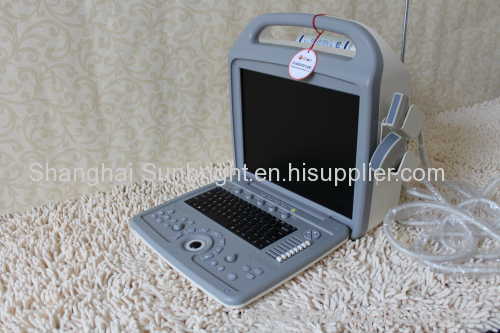 high quality 3D&4D portable color doppler ultrasound/Laptop color doppler 4d ultrasound system