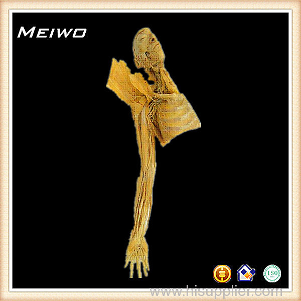 Difference between medical mdoel and plastinated specimens