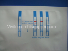 HBsAg Test Strip/Hepatitis B Surface Antigen Test Strip