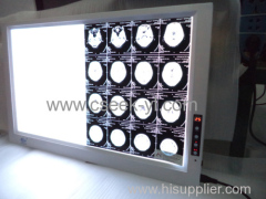 Factory price two screens led x-ray film viewer