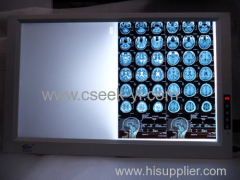 Factory price two/double screens led x-ray film viewer