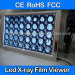 Factory price two screens led x-ray film viewer