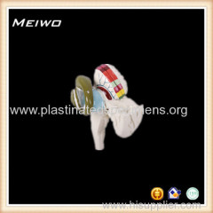 basal nulei and internal capsule anatomy model