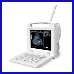 laptop ultrasound machine for Abdomen diagnosis