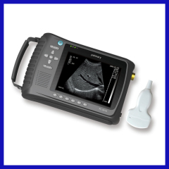 Best full digital laptop ultrasound diagnostic machine & ultrasonic scanner