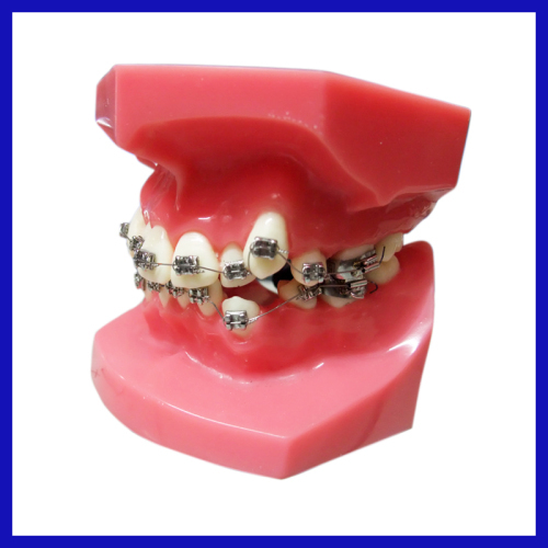 Manufacturer of 2 Layer Dental Acrylic Resin Teeth with OEM service