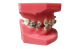Dental Acrylic Resin Teeth