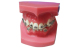 Dental Acrylic Resin Teeth