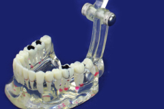 OEM service acrylic resin teeth for hospital