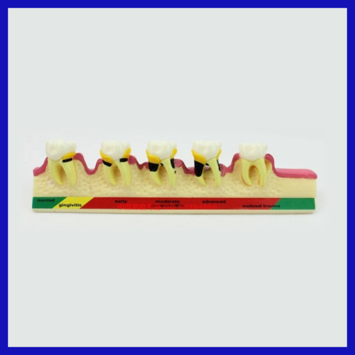 hopital artificial acrylic teeth