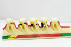 OEM service artificial acrylic teeth