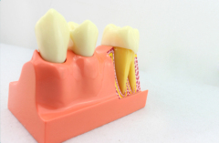 OEM service 4 times tooth body decomposition model