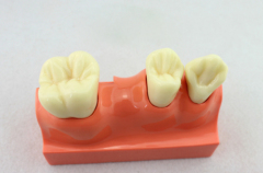 OEM service 4 times tooth body decomposition model