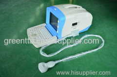 Portable ultrasound scanner&ultrasound machine price&USG
