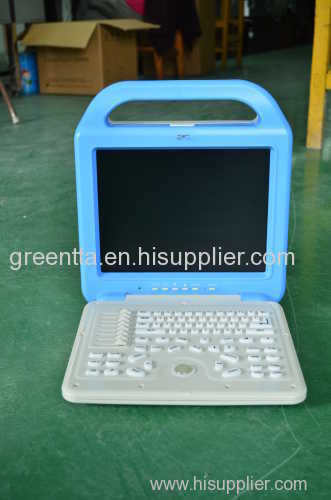 laptop ultrasound scanner ultrasound machine cheap price hot sale