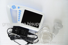 7in LCD Palm ultrasound scanner for human use& ultrasound machines price