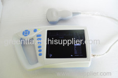 7in LCD Palm ultrasound scanner for human use& ultrasound machines price