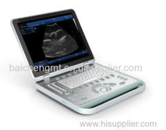 B&W Laoptop Ultrasound Scanner