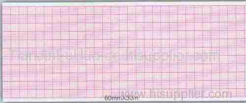 Three-Conduct Electrocardiograph Paper:ITALIAN THREE CONDUCT