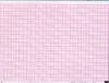 Six-Conduct Electrocardiograph Paper : NIHON KOHDEN-9010K/9020K/P