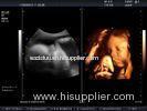 4D Color Doppler System Portable Ultrasound Scanner With High Definition LCD Monitor